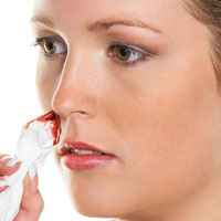 Кровотечение из носа: возможные причины и первая помощь 