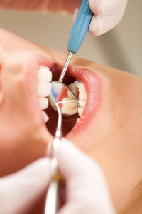 Удаление зубного камня – профилактика грозного заболевания 