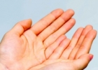 Почему потеют руки:  причины и способы борьбы с недугом